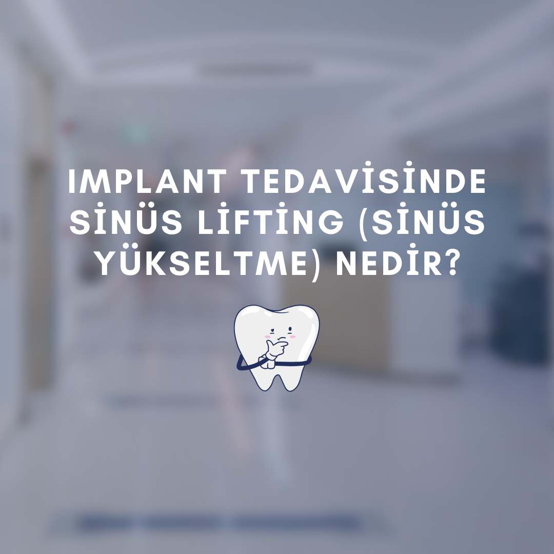 implant tedavisinde sinüs lifting (sinüs yükseltme) nedir