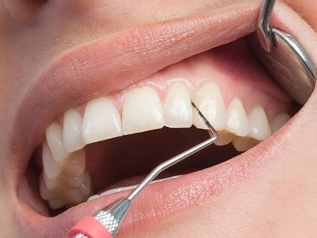 periodontal tedaviler