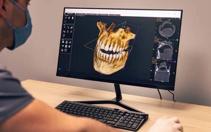 cbct Çekimi