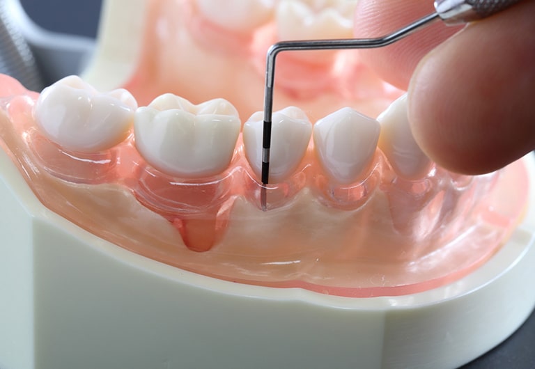 periodontoloji d