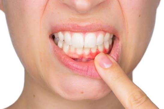 periodontoloji