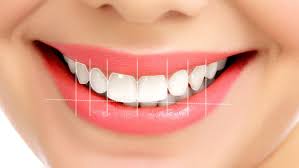 ankara hollywood smile (gülüş tasarımı)