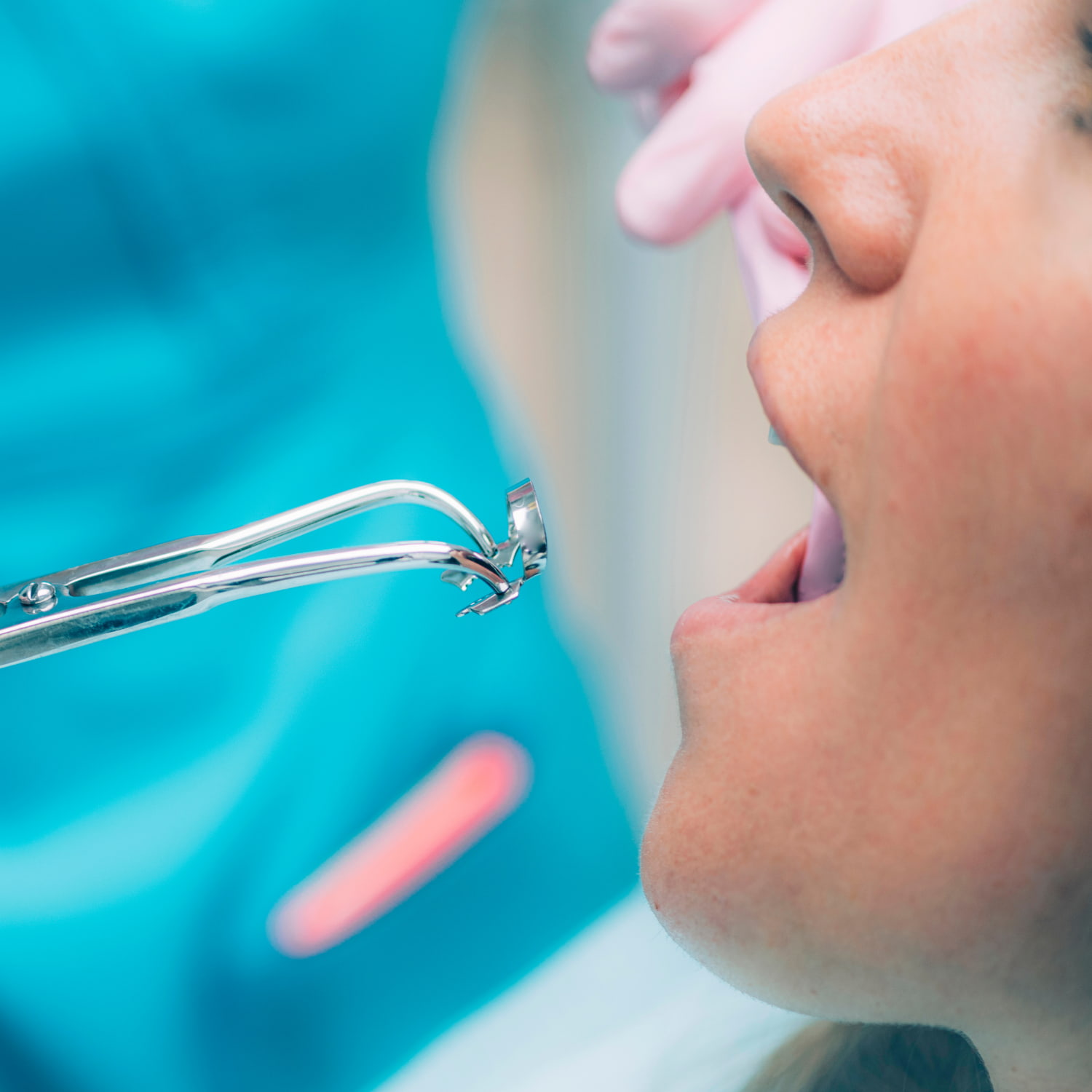 endodonti