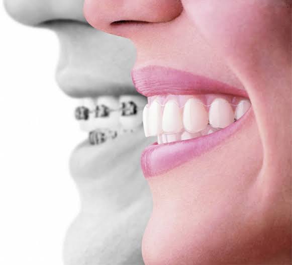 ortodonti tedavisine ne zaman başlanmalıdır